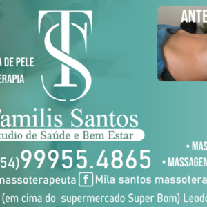 TAMILIS SANTOS MASSOTERAPEUTA EM CANELA RS